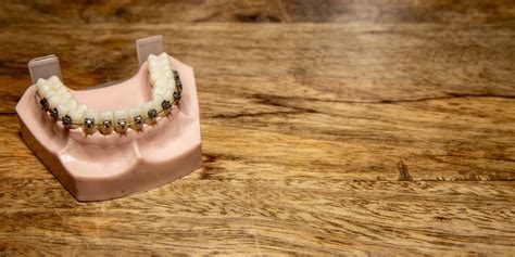 The Truth Behind Crooked Bottom Teeth: Causes and .